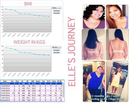 My Gastric Sleeve Journey Anniversary